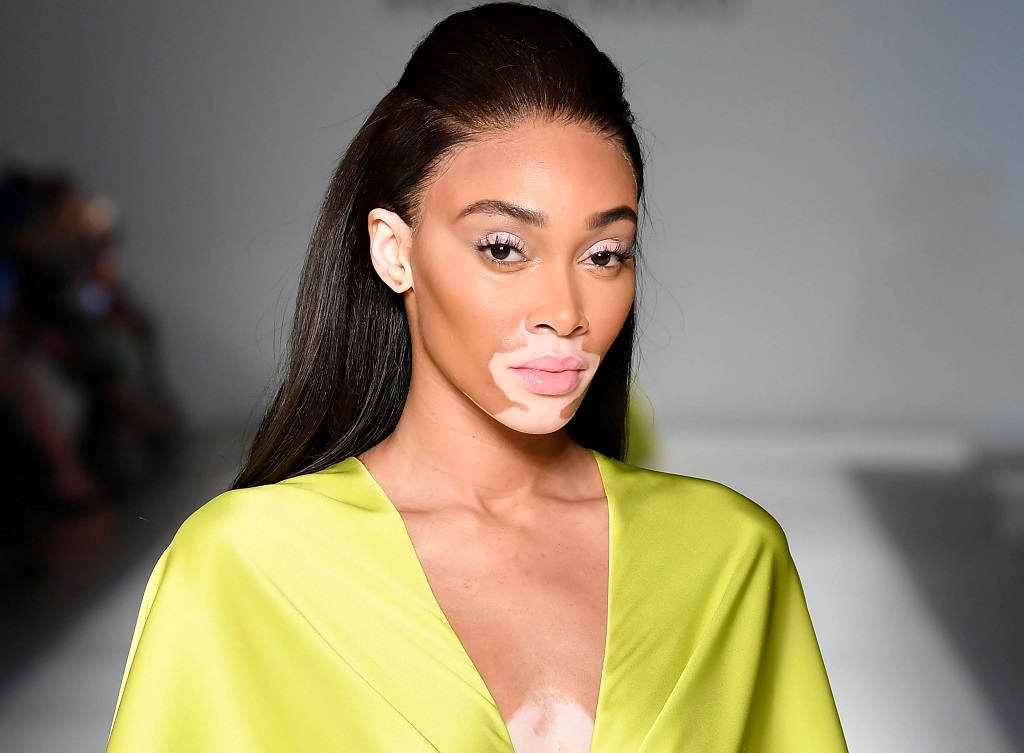 Is Winnie Harlow Related To Jack Harlow? Their Relationship And Facts