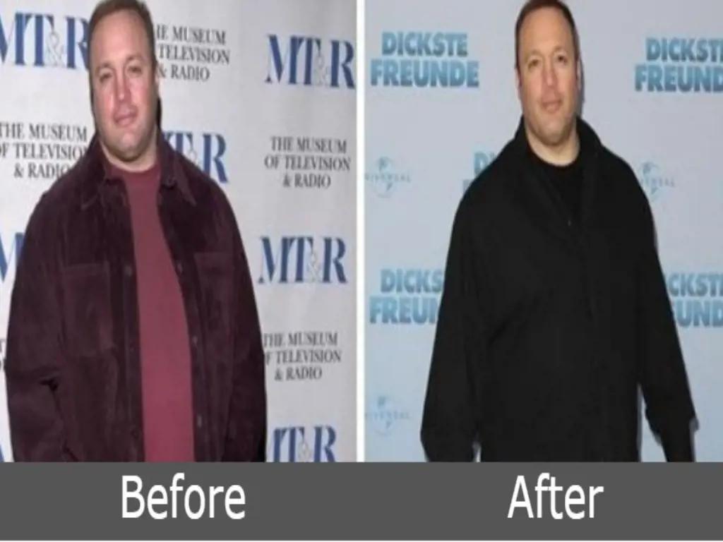 Kevin James Before and After photos 
